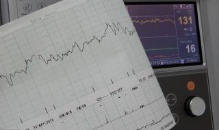 心衰的6个早期信号